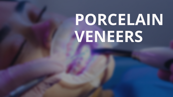 Porcelain Veneers